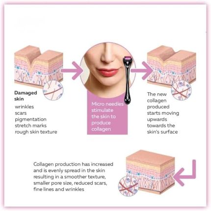 Derma Roller System 540 Needles Derma for Face and Skin Care - 0.75mm