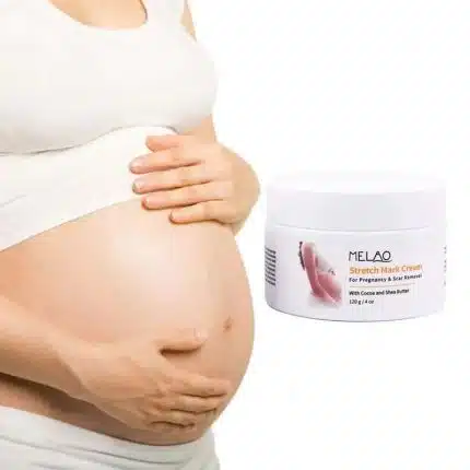 Melao Stretch Mark Cream Pregnancy Stretch Mark Removal Treatment - 120g